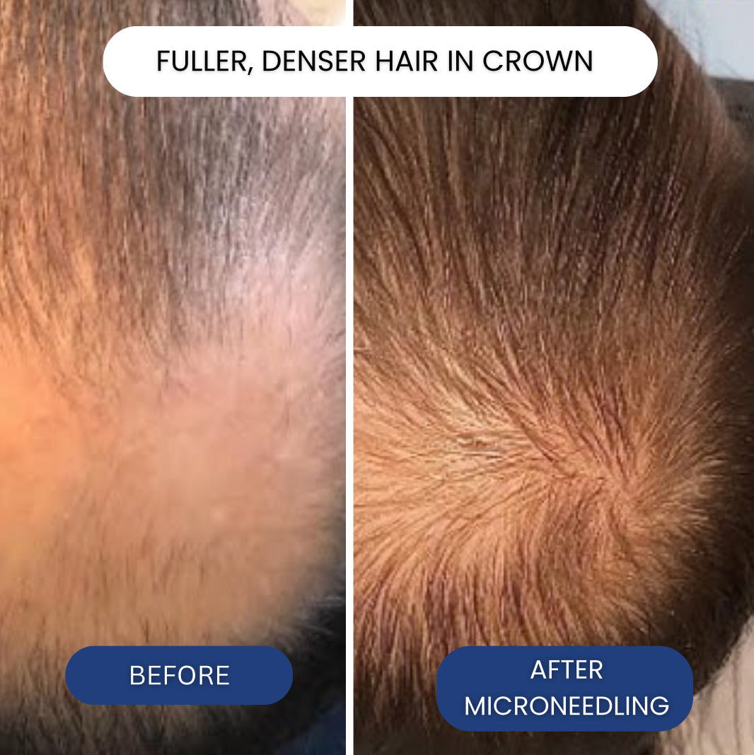 Your Damaged Scalp Barrier May Be Why Hair Treatments Stop Working