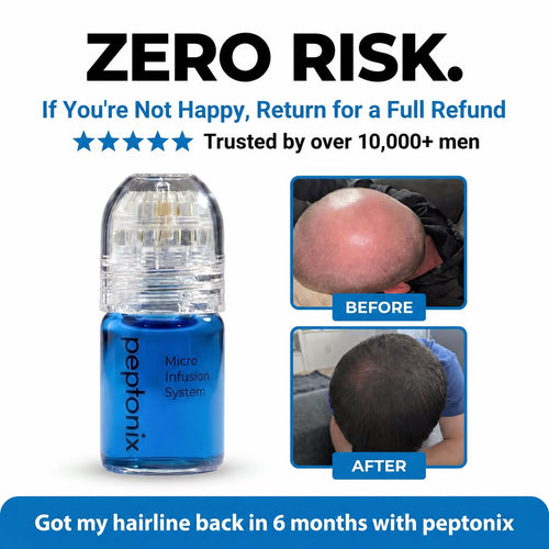The Most Powerful Peptide Infusion  Hair Regrowth System