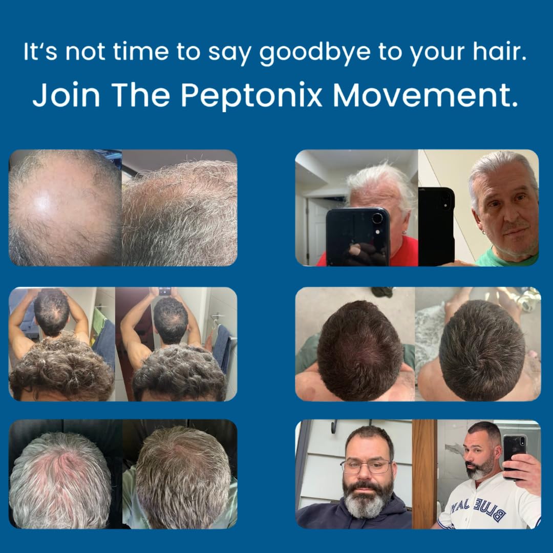 The Most Powerful Peptide Infusion  Hair Regrowth System